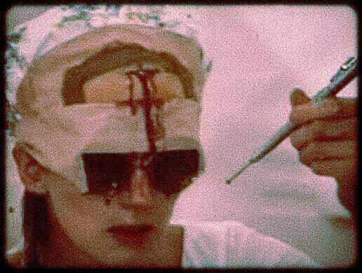 Gruesome Holes In The Head: The Horrifying History &Amp; Gory Details Of Trepanation